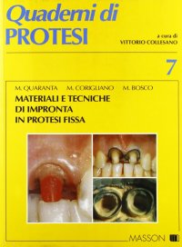 Materiali e tecniche di impronta in protesi fissa