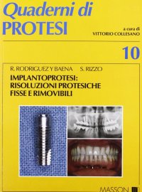 Implantoprotesi: risoluzioni protesiche fisse e rimovibili
