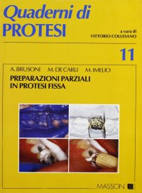 Preparazioni parziali in protesi fissa