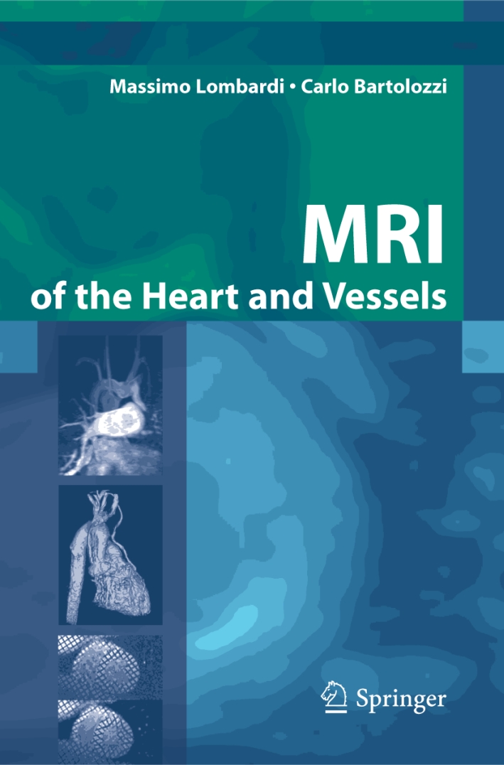 MRI of the heart and vessels MRI of the heart and vessels