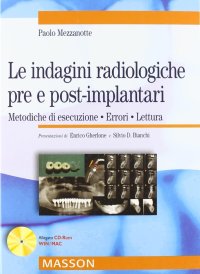 Le indagini radiologiche pre e post-implantari. Metodiche di esecuzione. Errori. Lettura