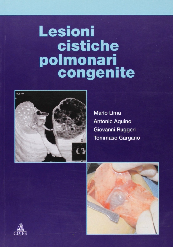 Lesioni cistiche polmonari congenite Lesioni cistiche polmonari congenite