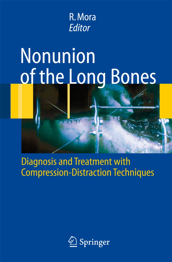 Nununion of the long bones. Diagnosis and treatment with compression-distraction techniques Nununion of the long bones. Diagnosis and treatment with compression-distraction techniques