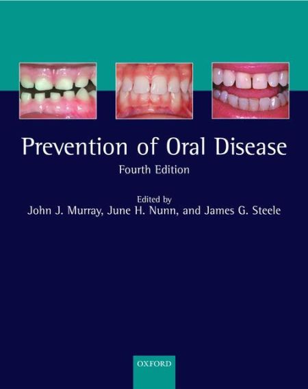 Prevention of Oral Disease Prevention of Oral Disease