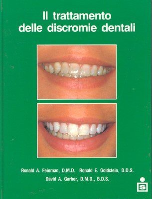 Il trattamento delle discromie dentali Il trattamento delle discromie dentali