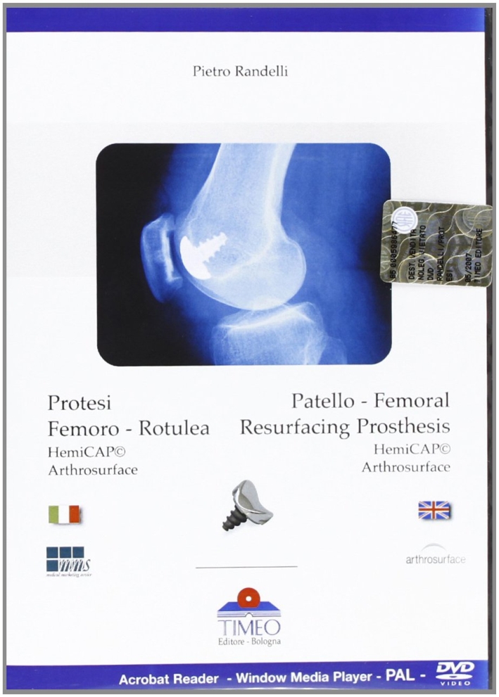 Protesi femoro rotulea-Patello femoral resurfacing prosthesis. DVD-ROM. Ediz. bilingue Protesi femoro rotulea-Patello femoral resurfacing prosthesis. DVD-ROM. Ediz. bilingue