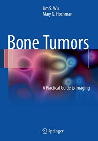Bone Tumors: a Practical Guide To Imaging
