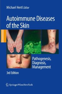 Autoimmune Diseases of the Skin: Pathogenesis, Diagnosis, Management