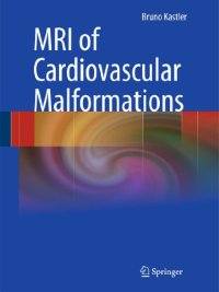 Mri of Cardiovascular Malformations