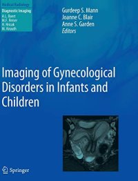 Imaging of Gynecological Disorders in Infants and Children