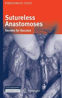 Sutureless Anastromoses: Secrets For Success