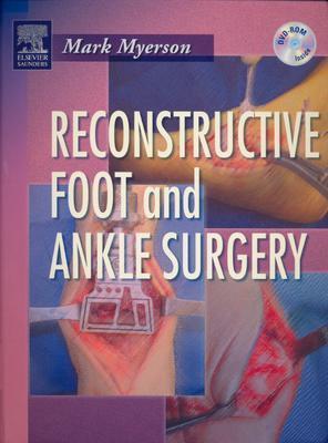 Reconstructive Foot and Ankle Surgery Reconstructive Foot and Ankle Surgery