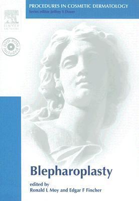 Blepharoplasty Blepharoplasty