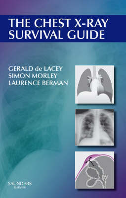 The Chest X-ray Survival Guide The Chest X-ray Survival Guide