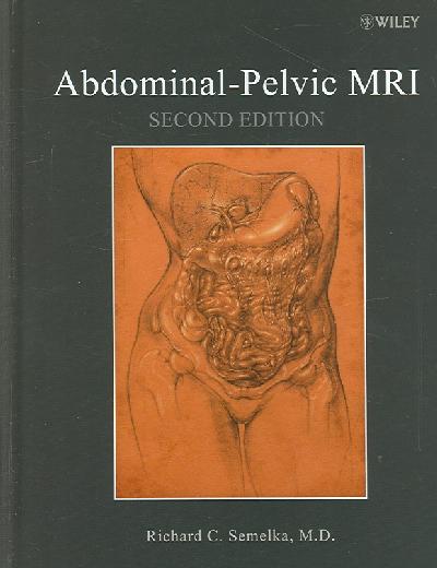 Abdominal-Pelvic MRI Abdominal-Pelvic MRI
