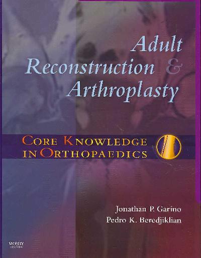 Adult Reconstruction and Arthroplasty Adult Reconstruction and Arthroplasty