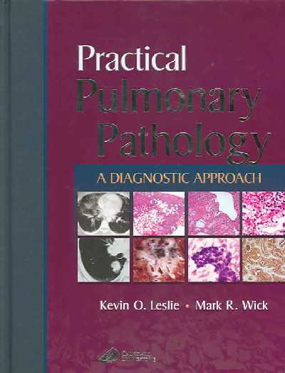 Practical Pulmonary Pathology. Practical Pulmonary Pathology.
