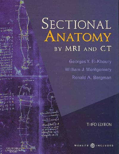 Sectional Anatomy by MRI and CT. Sectional Anatomy by MRI and CT.