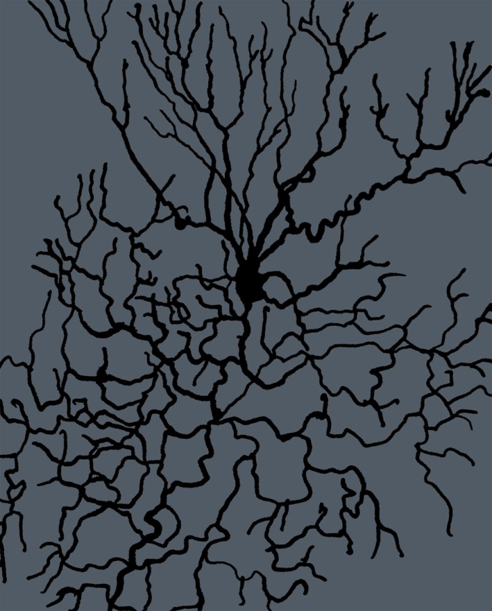 Insomnia