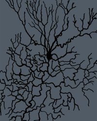 Insomnia