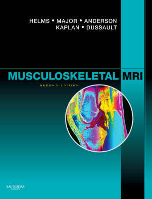 Musculoskeletal MRI Musculoskeletal MRI
