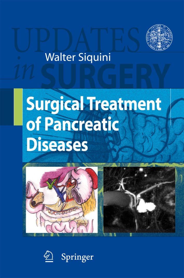 Surgical Treatment Of Pancreatic Disease Surgical Treatment Of Pancreatic Disease