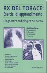 Rx del torace