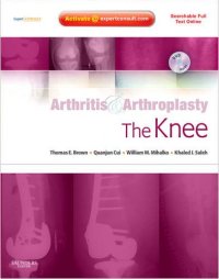 Knee