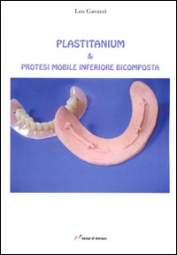 Plastitanium & protesi mobile inferiore bicomposta Plastitanium & protesi mobile inferiore bicomposta