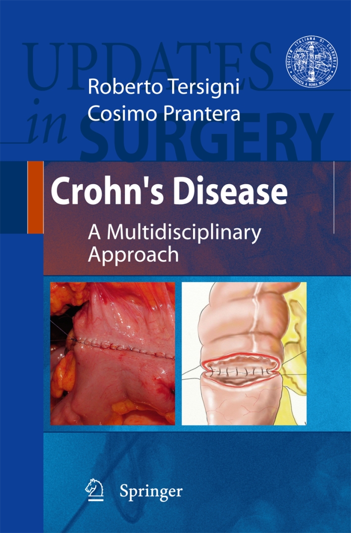Crohn's disease. A multidisciplinary approach series. Updates in surgery Crohn's disease. A multidisciplinary approach series. Updates in surgery