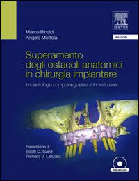 Superamento degli Ostacoli Anatomici in Chirurgia Implantare. Implantologia Computer-Guidata Innesti Ossei. con DVD Superamento degli Ostacoli Anatomici in Chirurgia Implantare. Implantologia Computer-Guidata Innesti Ossei. con DVD
