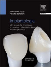 Implantologia. Mini-invasività, precisione ed estetica nella riabilitazione implantoprotesica Implantologia. Mini-invasività, precisione ed estetica nella riabilitazione implantoprotesica