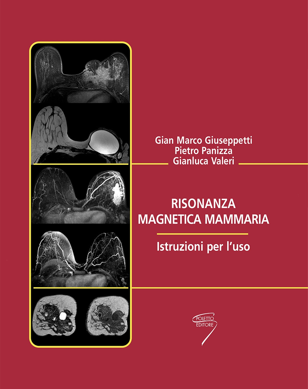 Risonanza magnetica mammaria. Istruzioni per l'uso Risonanza magnetica mammaria. Istruzioni per l'uso