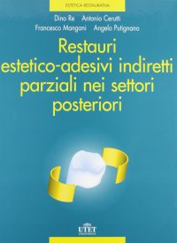 Restauri estetico-adesivi indiretti parziali nei settori posteriori