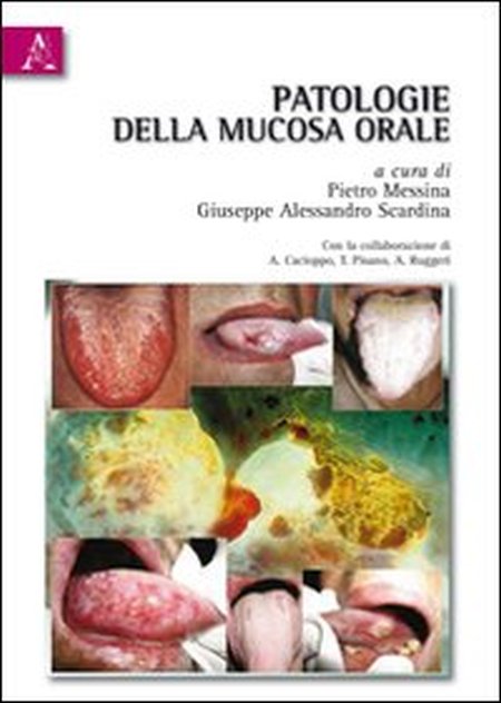 Patologie della mucosa orale. Patologie della mucosa orale.