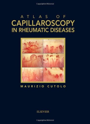 Atlas of Capillaroscopy in Rheumatic Diseases Atlas of Capillaroscopy in Rheumatic Diseases
