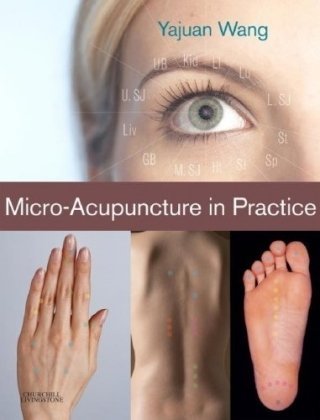 Micro-Acupuncture in Practice Micro-Acupuncture in Practice