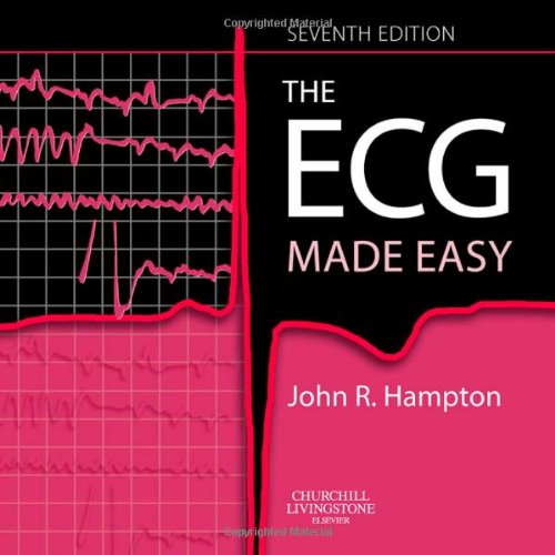 ECG Made Easy ECG Made Easy