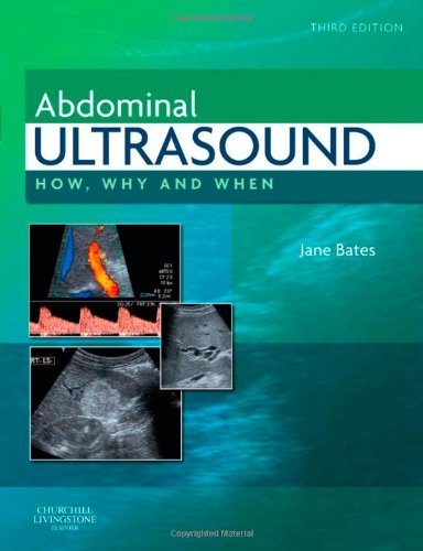 Abdominal Ultrasound Abdominal Ultrasound