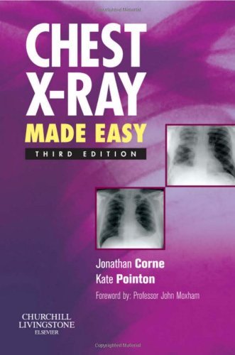 Chest X-Ray Made Easy Chest X-Ray Made Easy