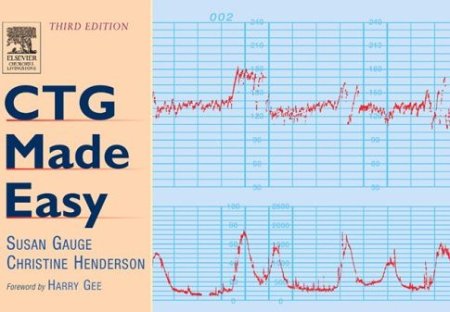 CTG Made Easy CTG Made Easy