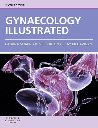 Gynaecology Illustrated Gynaecology Illustrated