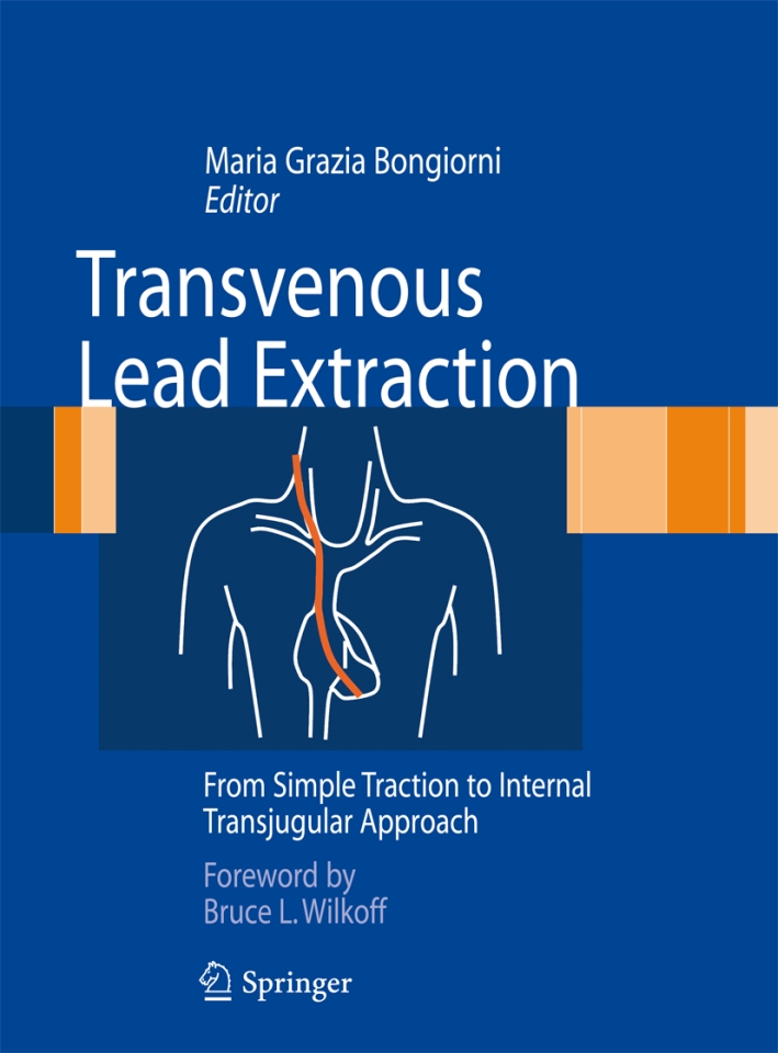 Transvenous lead extraction from simple traction to transjugular approach Transvenous lead extraction from simple traction to transjugular approach