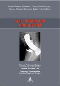 Malformazioni anorettali Malformazioni anorettali