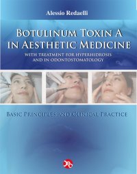 Botulinum toxin A in aesthetic medicine