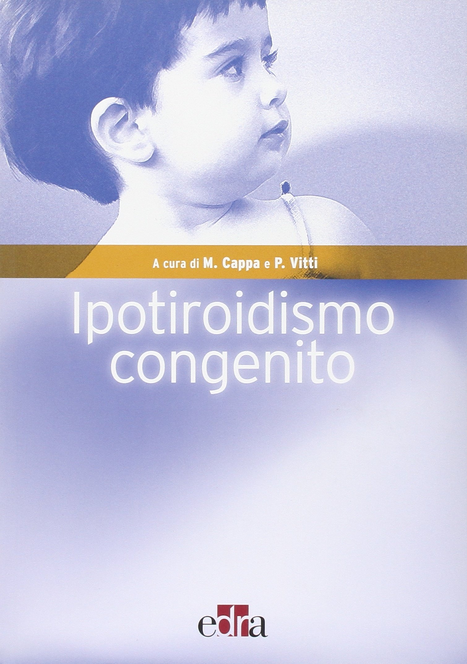 Ipotiroidismo Congenito Ipotiroidismo Congenito