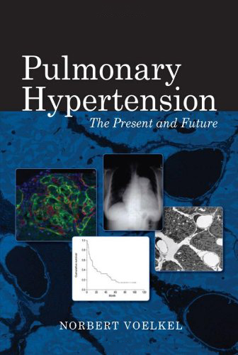 Pulmonary hypertension Pulmonary hypertension
