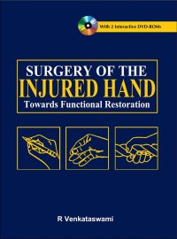 Surgery of the injured hand. Towards functional restoration