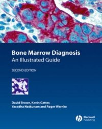 Bone Marrow Diagnosis