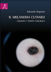 Il melanoma cutaneo. Diagnosi e terapia chirurgica Il melanoma cutaneo. Diagnosi e terapia chirurgica